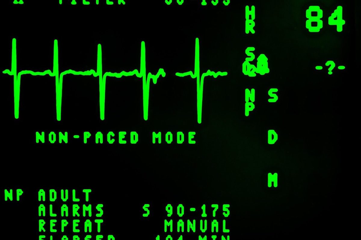 Variabilité de la fréquence cardiaque et récupération après