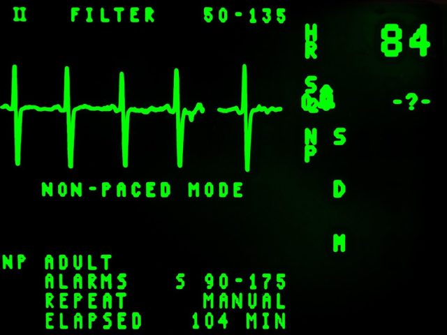 Variabilité de la fréquence cardiaque et récupération après